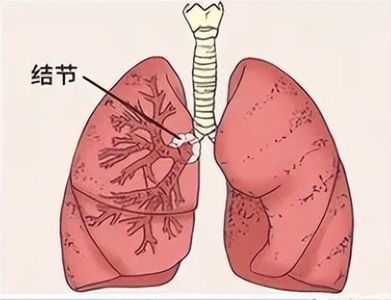 imtoken钱包迁移_imtoken钱包导入_钱包迁移方案